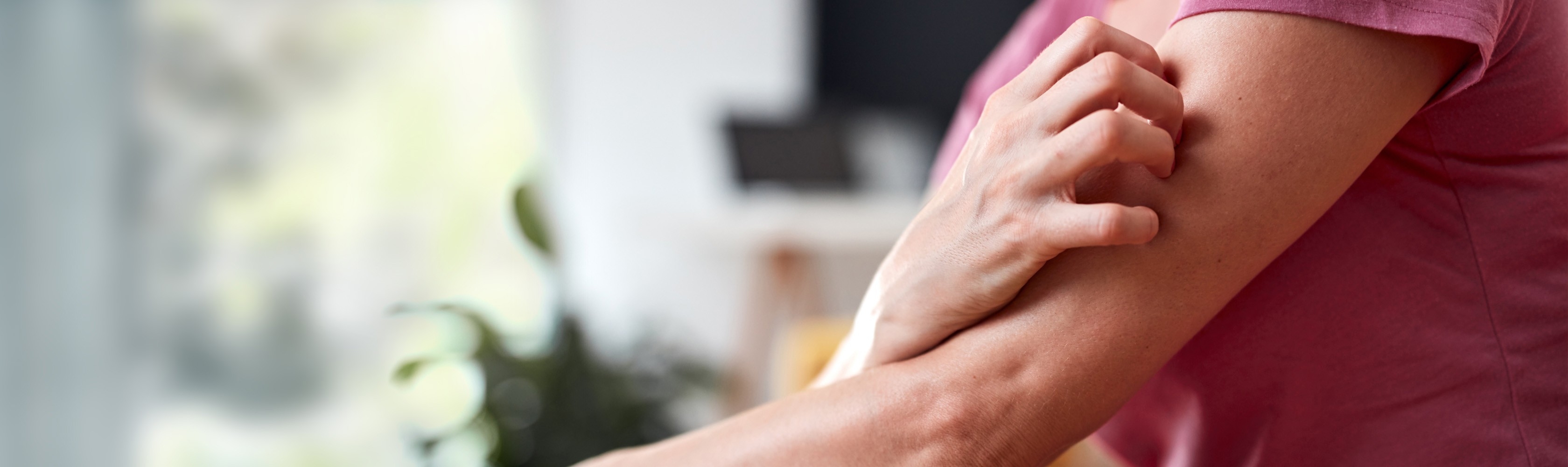 A woman is sitting on the sofa at home and touching a patch of eczema on her upper arm
